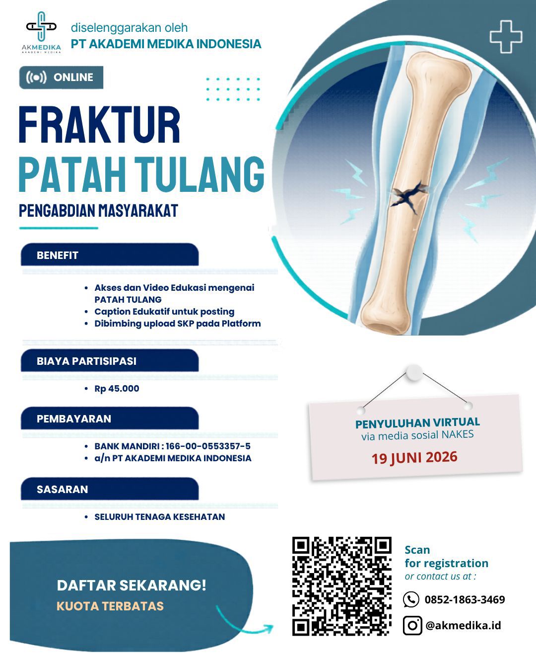 Pengabdian Masyarakat Melalui Media Sosial - Fraktur (Patah Tulang)